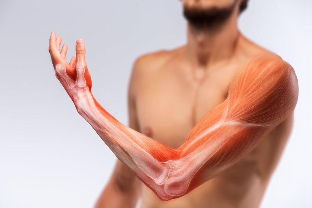 Muscles manuels et son traitement avec le traitement du gel Congelum
