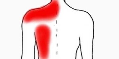 douleur sous l'omoplate gauche du dos